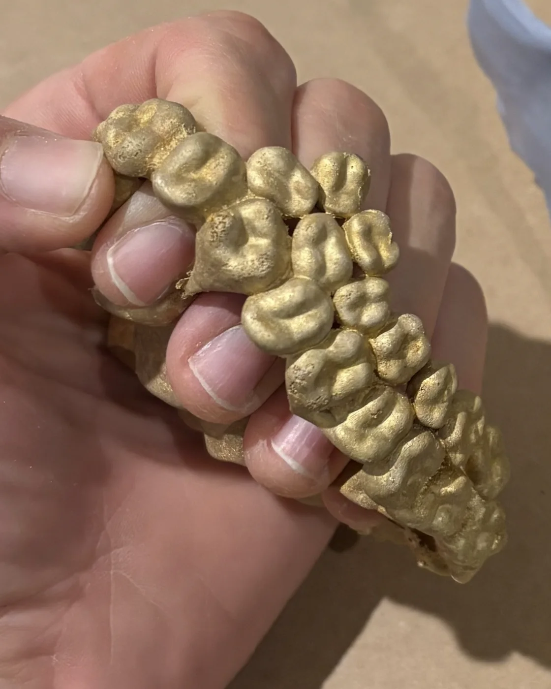 A full arch of teeth cast in gold, held in a hand